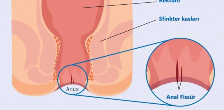 Yalangoch xotin oshxonada ovqat pishiradi 30 dan katta qizlar HD porno